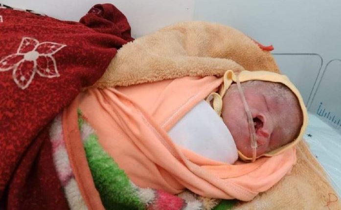 نتيجة استخدام الأسلحة المحرمة دوليا .. ولادة طفل بدون عينين وفم وانف في هذه المحافظة !