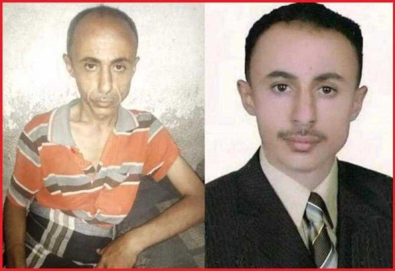 شاهد صورة الصحفي كيف اصبح بعد تدهور صحته جراء التعذيب الوحشي طوال اختطافه في سجون الحوثي 
