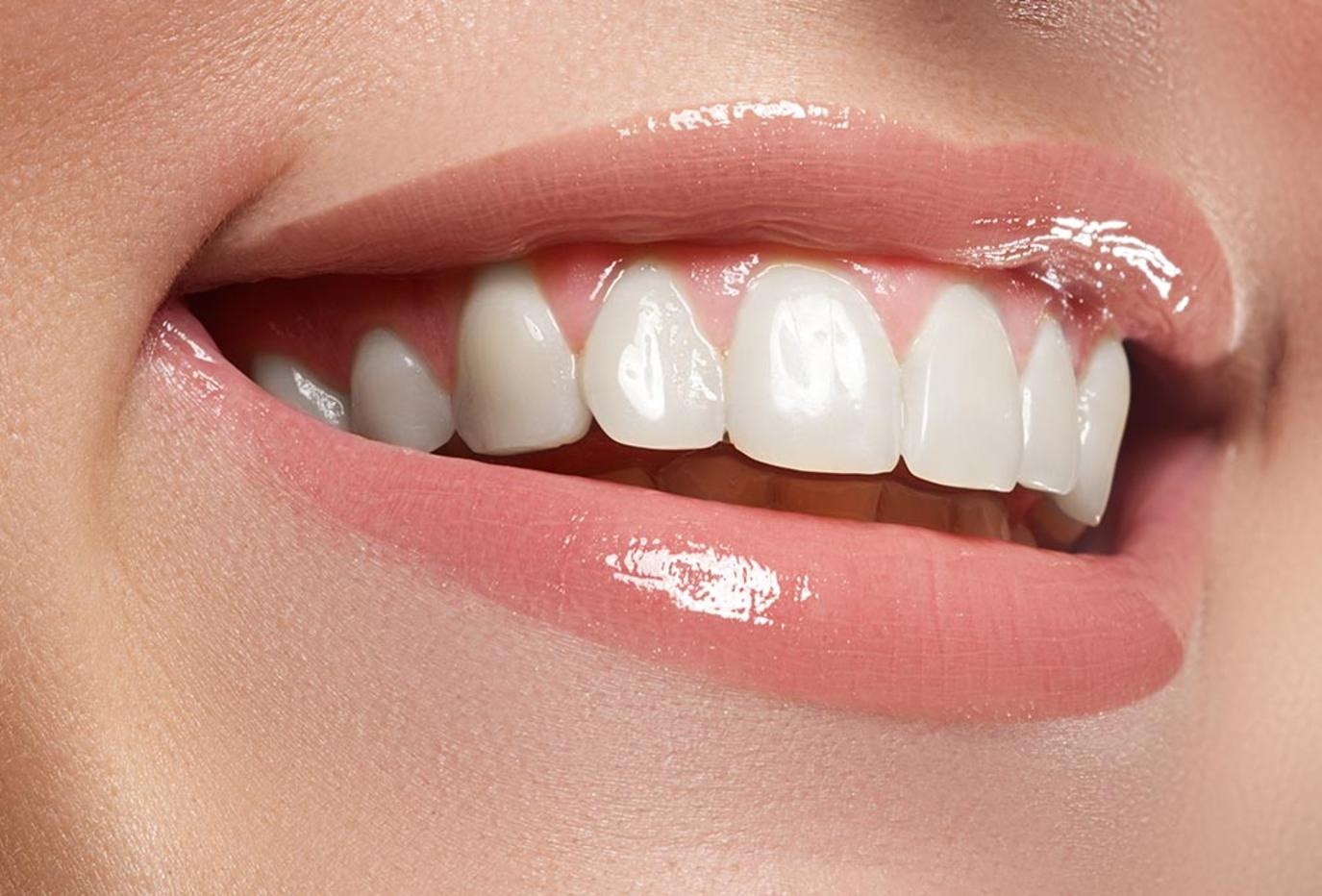 طريقة مذهلة لإزالة جير الأسنان بالمنزل بإتباع بعض الخطوات البسيطة