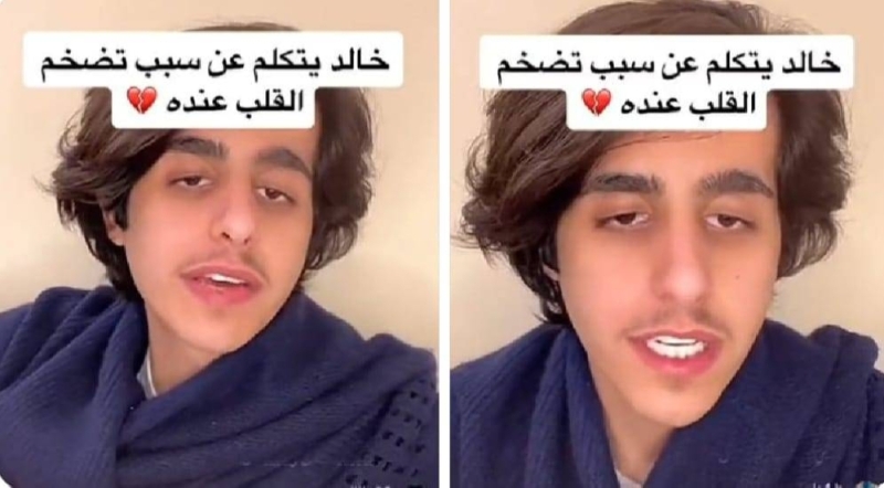 شاب سعودي يكشف عن المشروب الذي ادى لاصابته بتضخم في القلب 